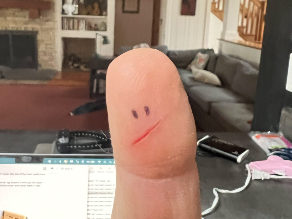 sliced finger with face